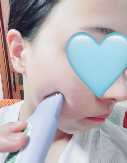 フリーズタグアイスローラー/CHASIN'RABBITS/美容液を使ったクチコミ(3枚目)