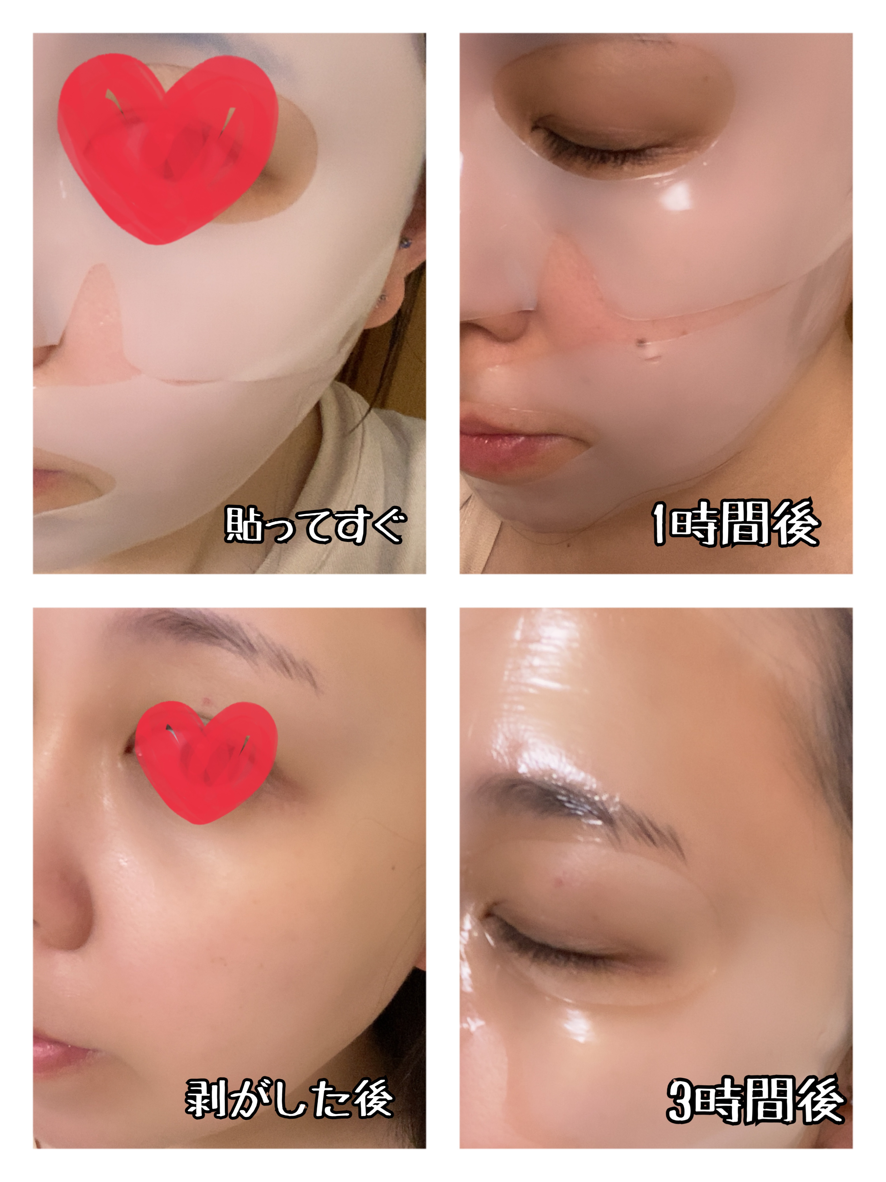 RXザ・アルファアルブチン2 ニキビ跡ケアセラム/COSRX/美容液を使ったクチコミ（2枚目）