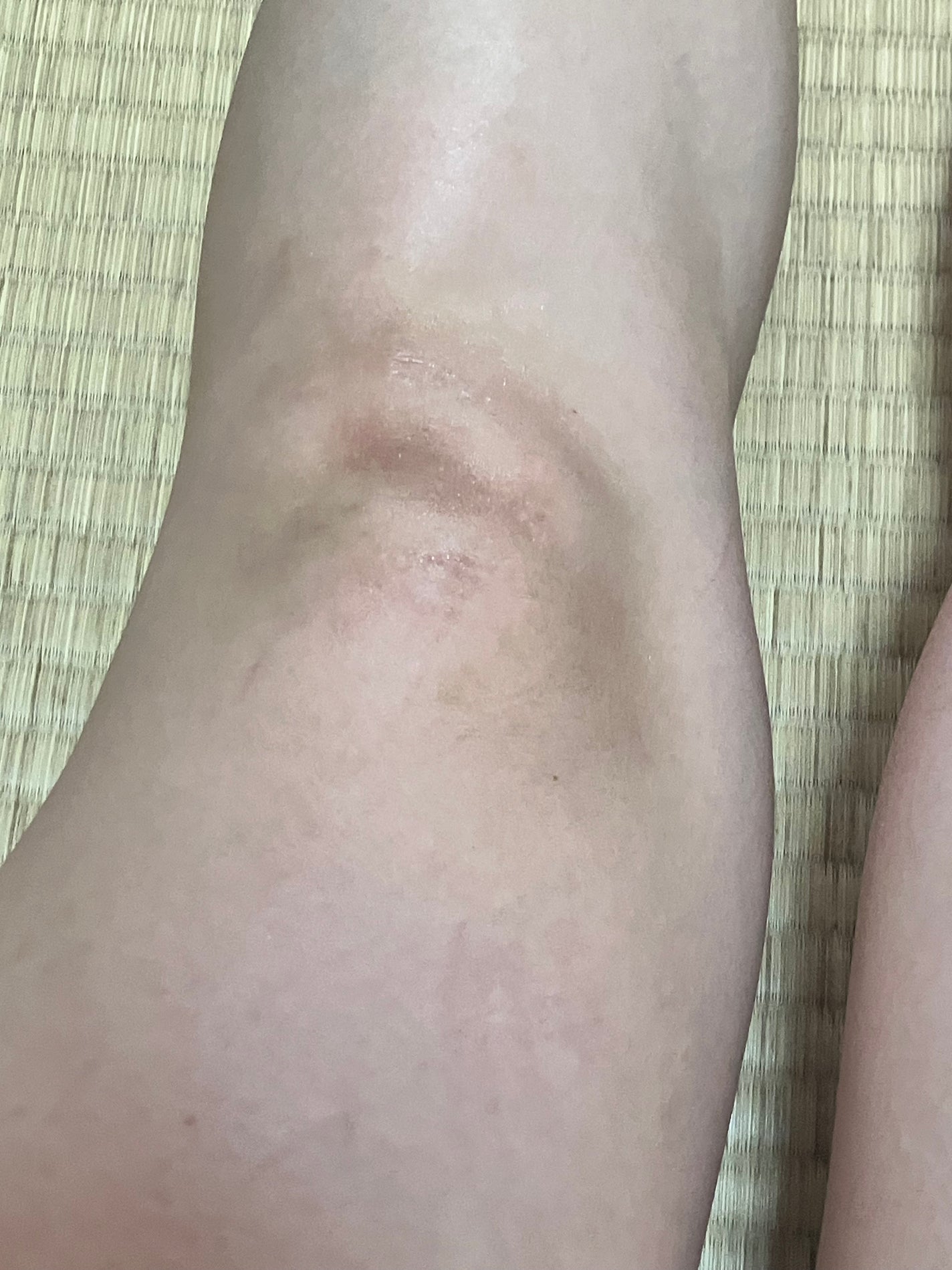 トリプル レチノール ウォッシュピール/Celladix/ピーリングを使ったクチコミ(1枚目)