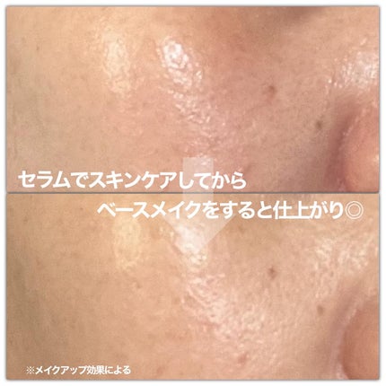 スキンブースティングフォルテセラム/essenciel/美容液を使ったクチコミ(5枚目)