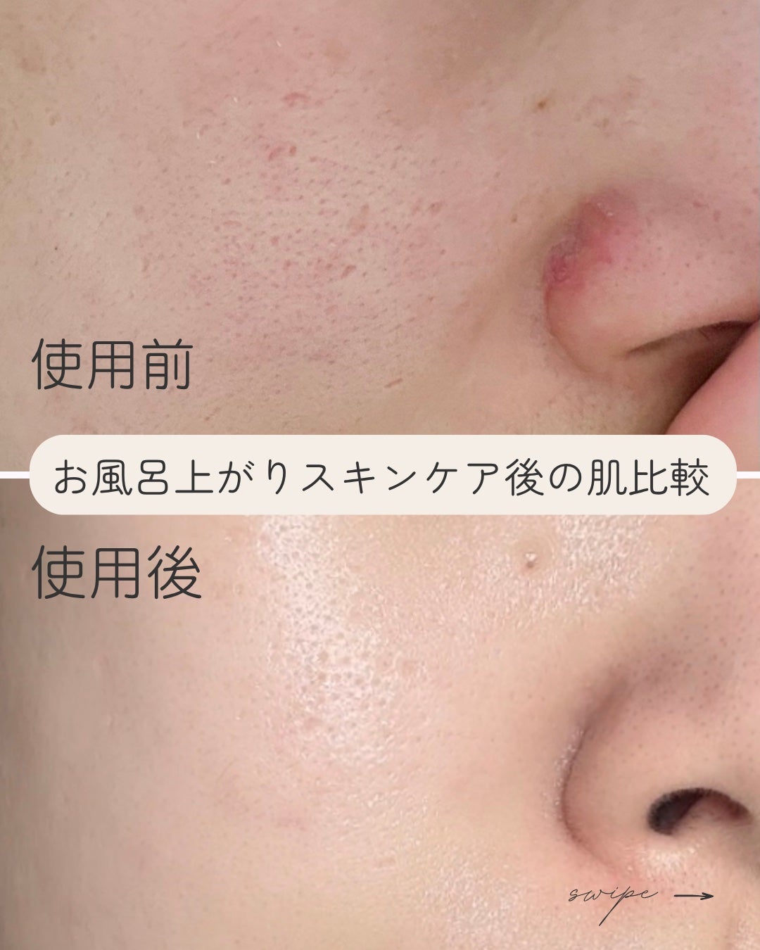 ノスカナイン トラブル セラム/FATION/美容液を使ったクチコミ(7枚目)