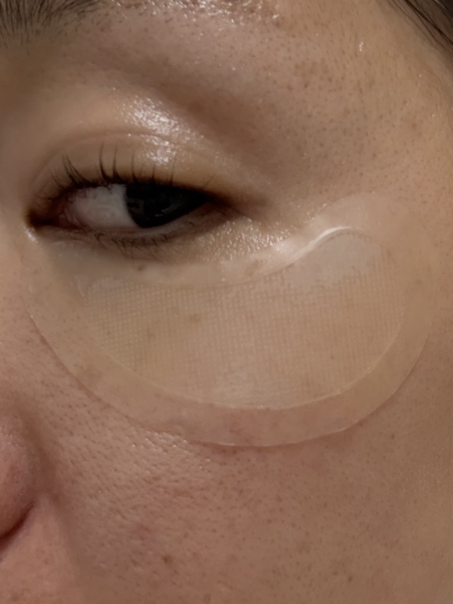 アイバックリフト1100シャットリードルパッチ/CHARDE/シートマスク・パックを使ったクチコミ（2枚目）