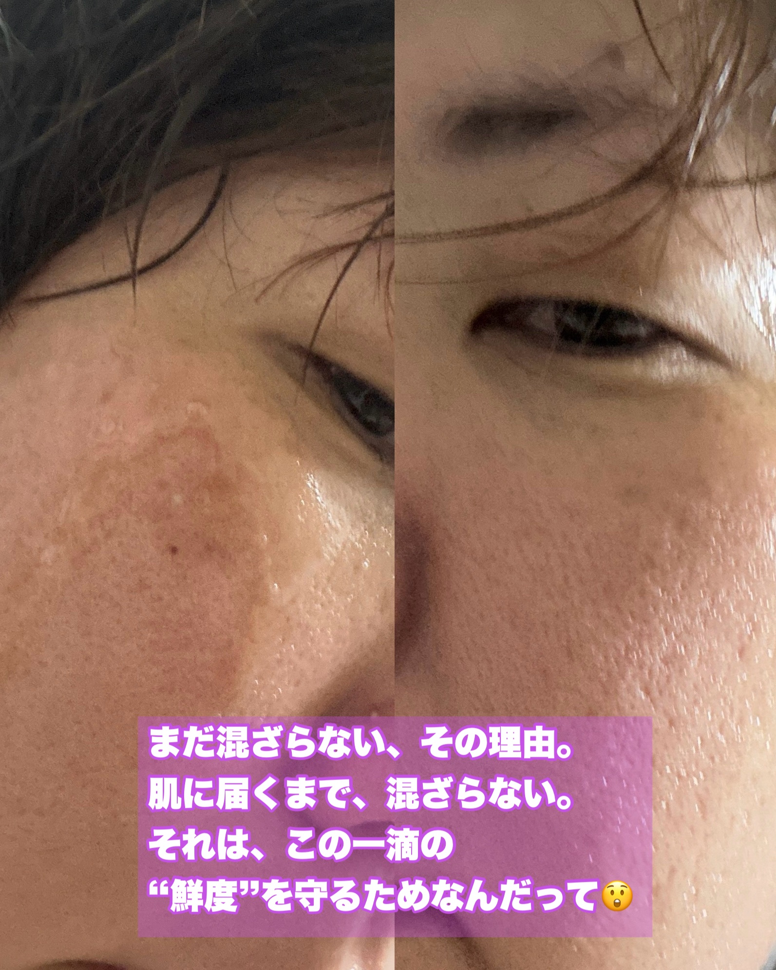 ビタプル ダブルアクション リペアセラム 15/VITAPURU/美容液を使ったクチコミ（3枚目）