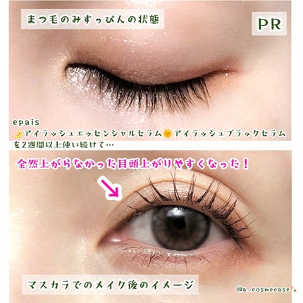 アイラッシュエッセンシャルセラム/epais/まつげ美容液を使ったクチコミ(3枚目)