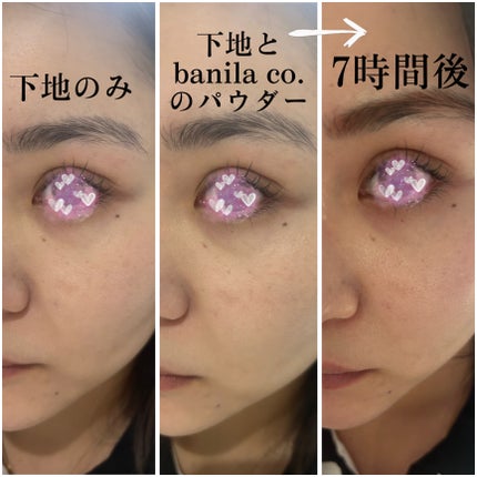 ã±ã€ã ãã¢ã¬ã¹ããŒã㌠FORãã©ã€&ãªã€ãªãŒ/KATE/åç²§äžå°ã䜿ã£ãã¯ãã³ãïŒ7æç®ïŒ