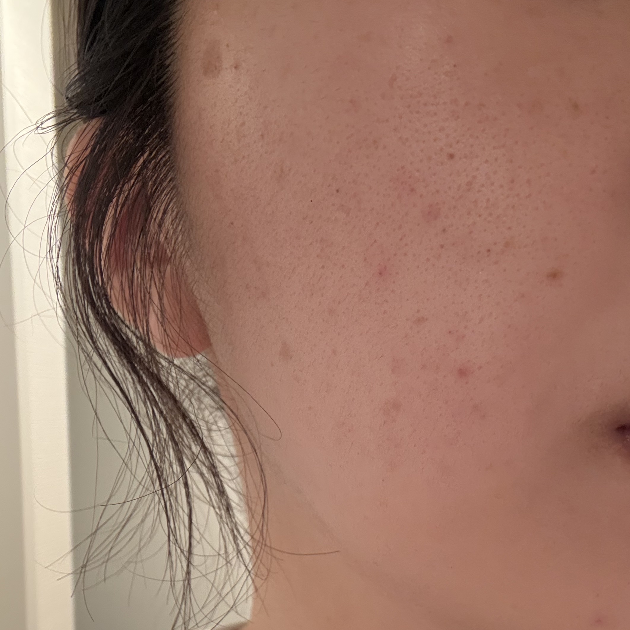 薬用 しみ 集中対策 美容液/メラノCC/美容液を使ったクチコミ（2枚目）