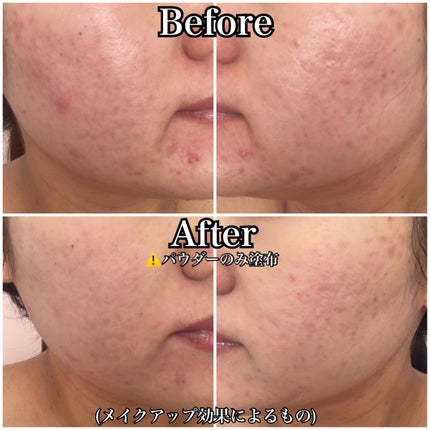 トランスルーセントセットフィニッシングパウダー/TFIT/ルースパウダーを使ったクチコミ(5枚目)