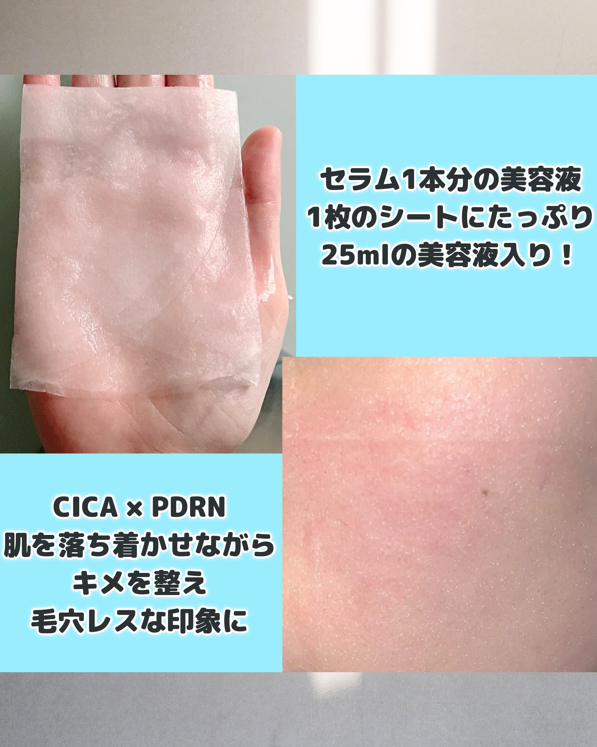 バイオームレメディポアリセットPDRN カーミングマスク/UIQ/シートマスク・パックを使ったクチコミ（2枚目）