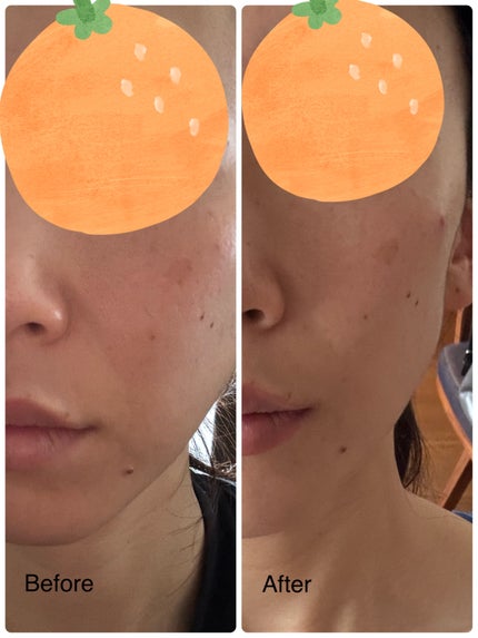 PDRNカフェインショット/IOPE/美容液を使ったクチコミ(3枚目)