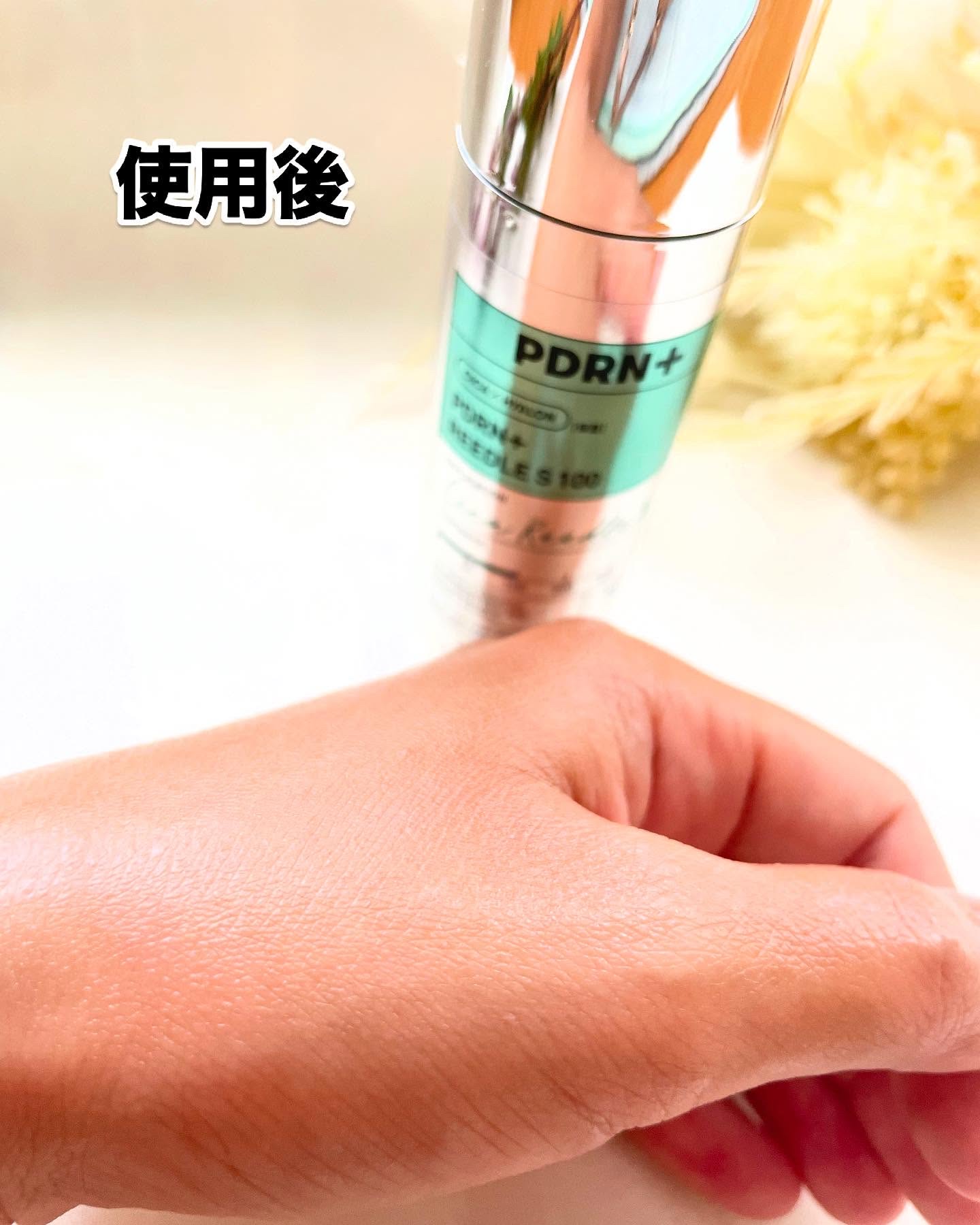 PDRN+リードルS 100 1+1（80mL×2個）/VT/美容液を使ったクチコミ（2枚目）