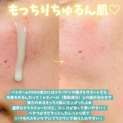 ReDRNエクソソームアンプル/Dr.nineteen/美容液を使ったクチコミ(3枚目)