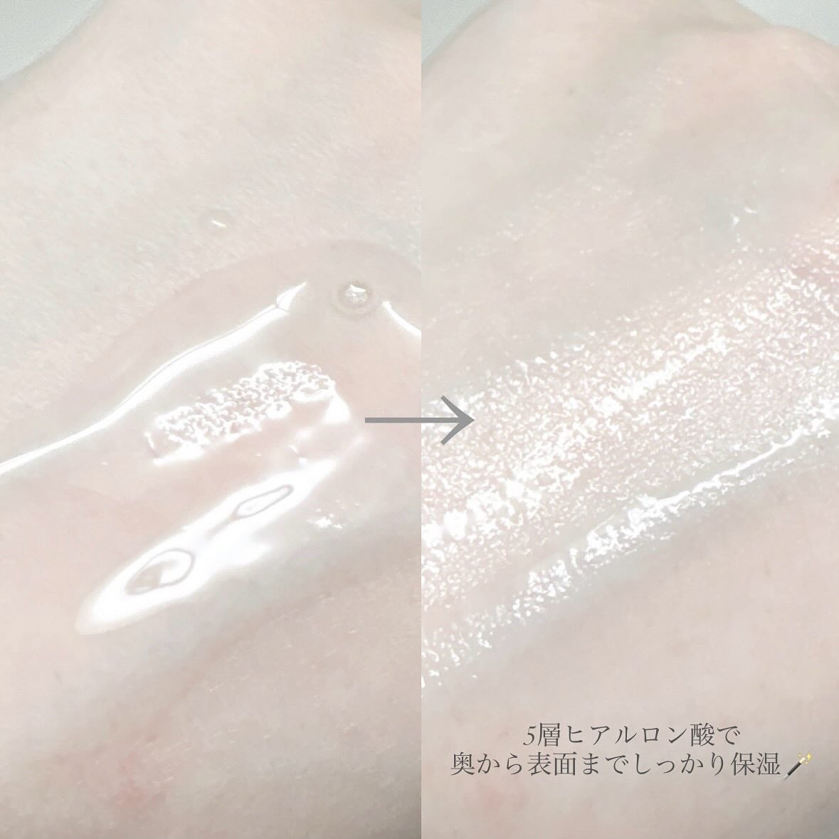 ビーガントナーパッド/CHOROK CHORONG/トナーパッドを使ったクチコミ(5枚目)