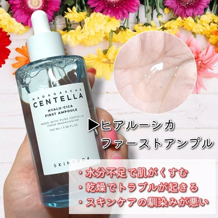 ã»ã³ãã© ã¢ã³ãã«/SKIN1004/çŸå®¹æ¶²ã䜿ã£ãã¯ãã³ãïŒ3æç®ïŒ