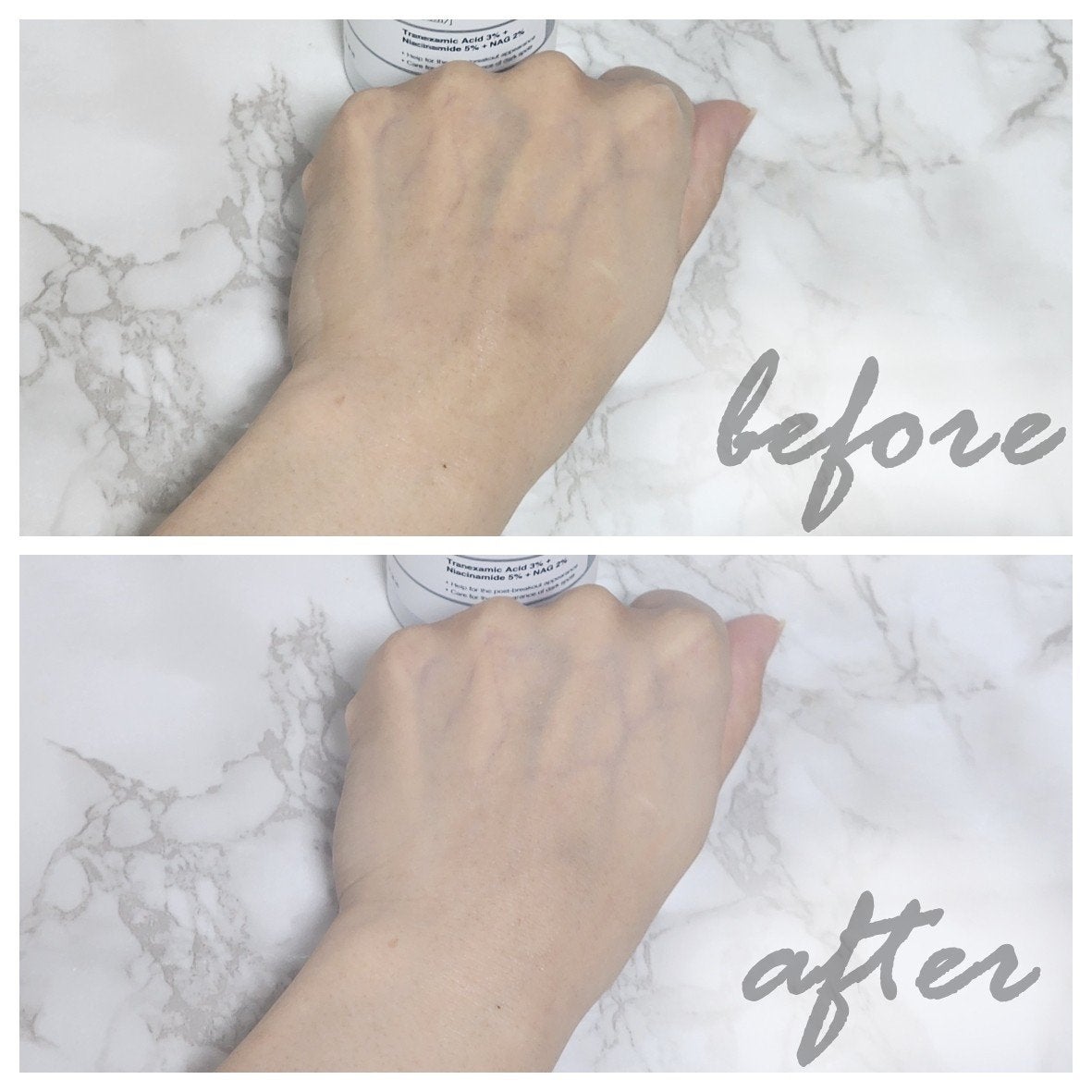 RXザ・アルファアルブチン2 ニキビ跡ケアセラム/COSRX/美容液を使ったクチコミ(6枚目)