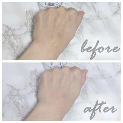 RXザ・アルファアルブチン2 ニキビ跡ケアセラム/COSRX/美容液を使ったクチコミ(6枚目)