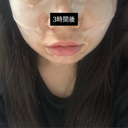 RXザ・アルファアルブチン2 ニキビ跡ケアセラム/COSRX/美容液を使ったクチコミ(5枚目)