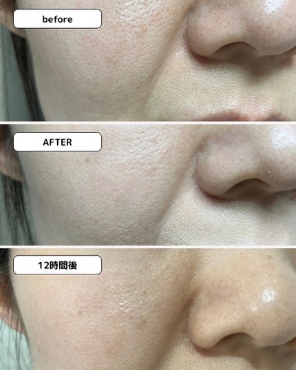 ジヴェルニー 密着カバーファンデーション/GIVERNY/リキッドファンデーションを使ったクチコミ(9枚目)