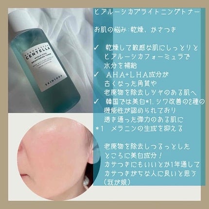 センテラ トーニングトナー/SKIN1004/化粧水を使ったクチコミ(3枚目)