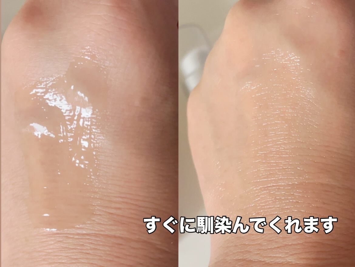 ベリー on LIPS 「韓国を代表するドクターズコスメイージーデュー。『DW-EGFメ..」(5枚目)