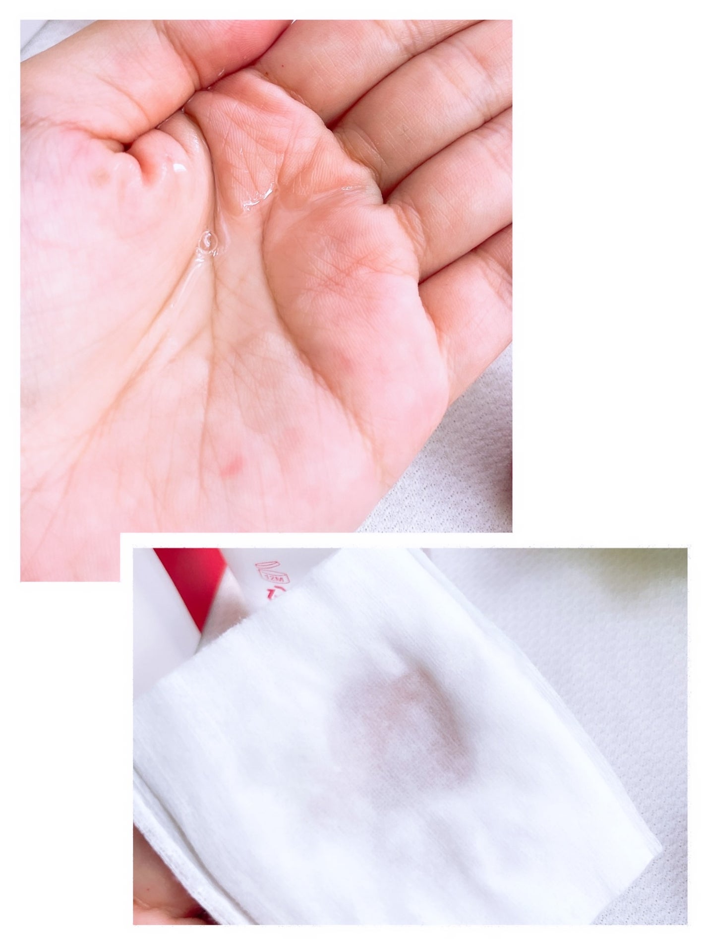 SOSスポットクリアトナー/One-day's you/化粧水を使ったクチコミ(3枚目)