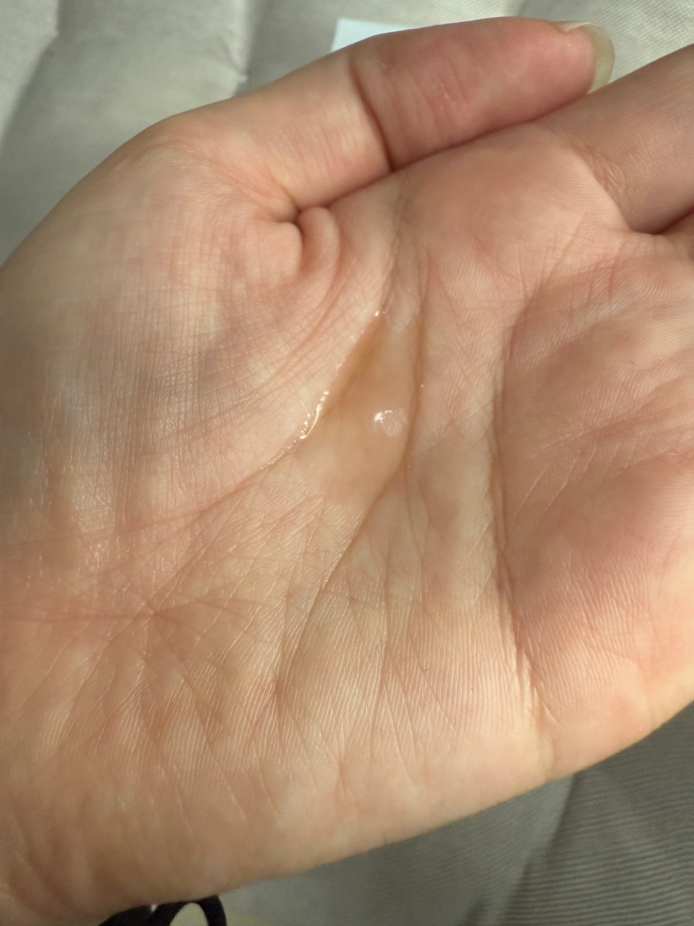 RXザ・アルファアルブチン2 ニキビ跡ケアセラム/COSRX/美容液を使ったクチコミ(7枚目)