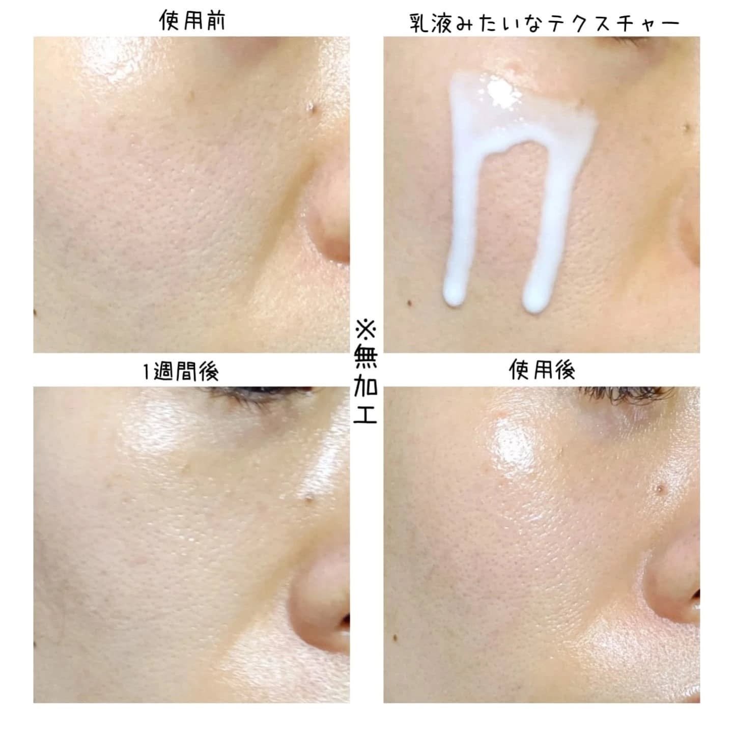 リードルS PDRN+ セラム/VT/美容液を使ったクチコミ（3枚目）