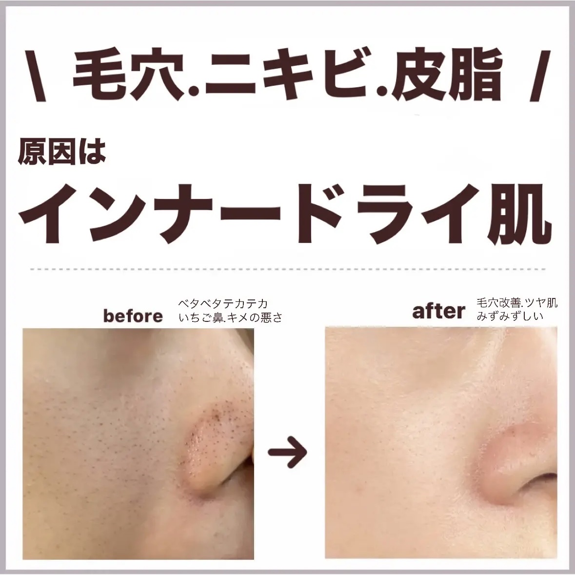 スキンモイストW/PLUSRESTORE/乳液を使ったクチコミ（1枚目）