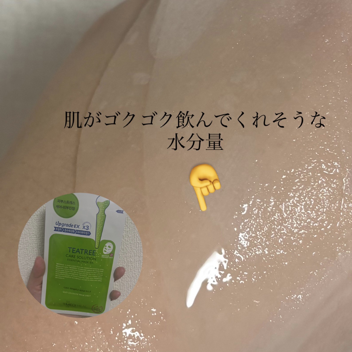 ティーツリーケア ソリューション エッセンシャルマスクEX/MEDIHEAL/シートマスク・パックを使ったクチコミ（2枚目）