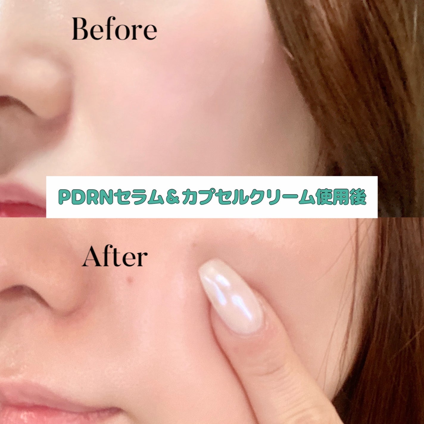 リードルS PDRN+ セラム/VT/美容液を使ったクチコミ(4枚目)