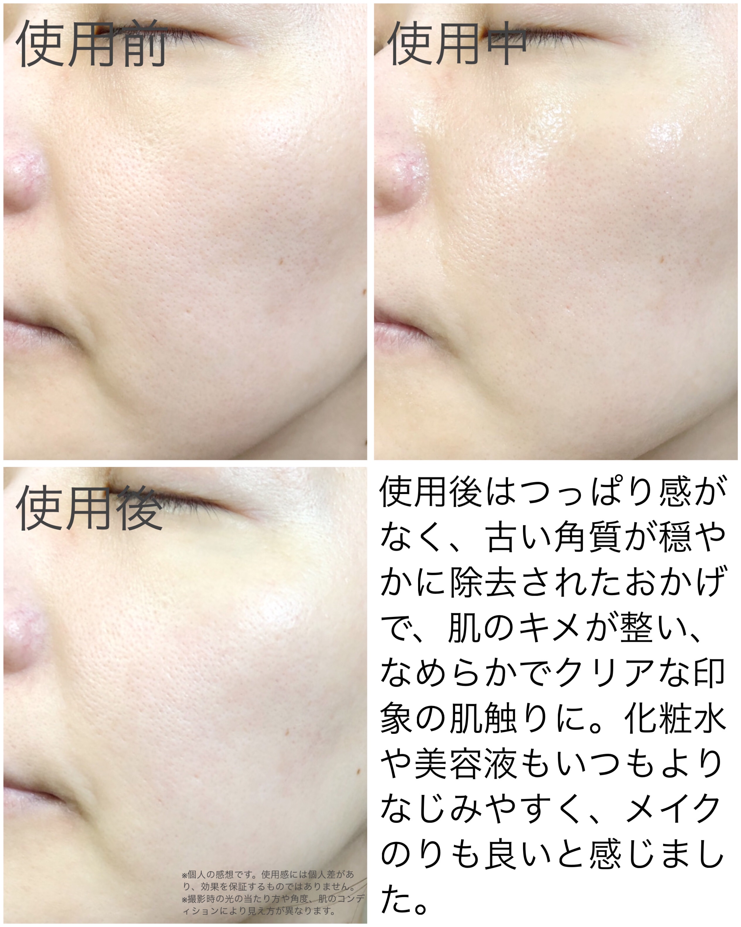 トリプル レチノール ウォッシュピール/Celladix/ピーリングを使ったクチコミ（3枚目）