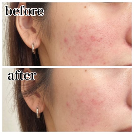 エッセンスベース EX/マキアージュ/化粧下地を使ったクチコミ(4枚目)