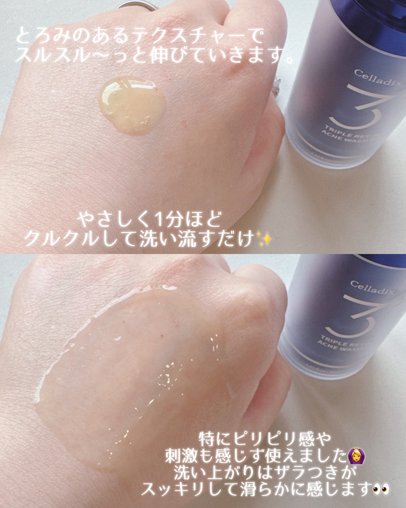 トリプル レチノール ウォッシュピール/Celladix/ピーリングを使ったクチコミ(3枚目)