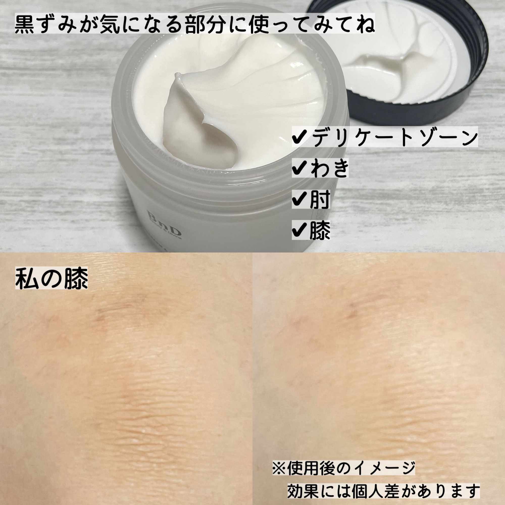 BnDアンダーアームクリーム(ボディクリーム)/BnD/デリケートゾーンケアを使ったクチコミ（3枚目）