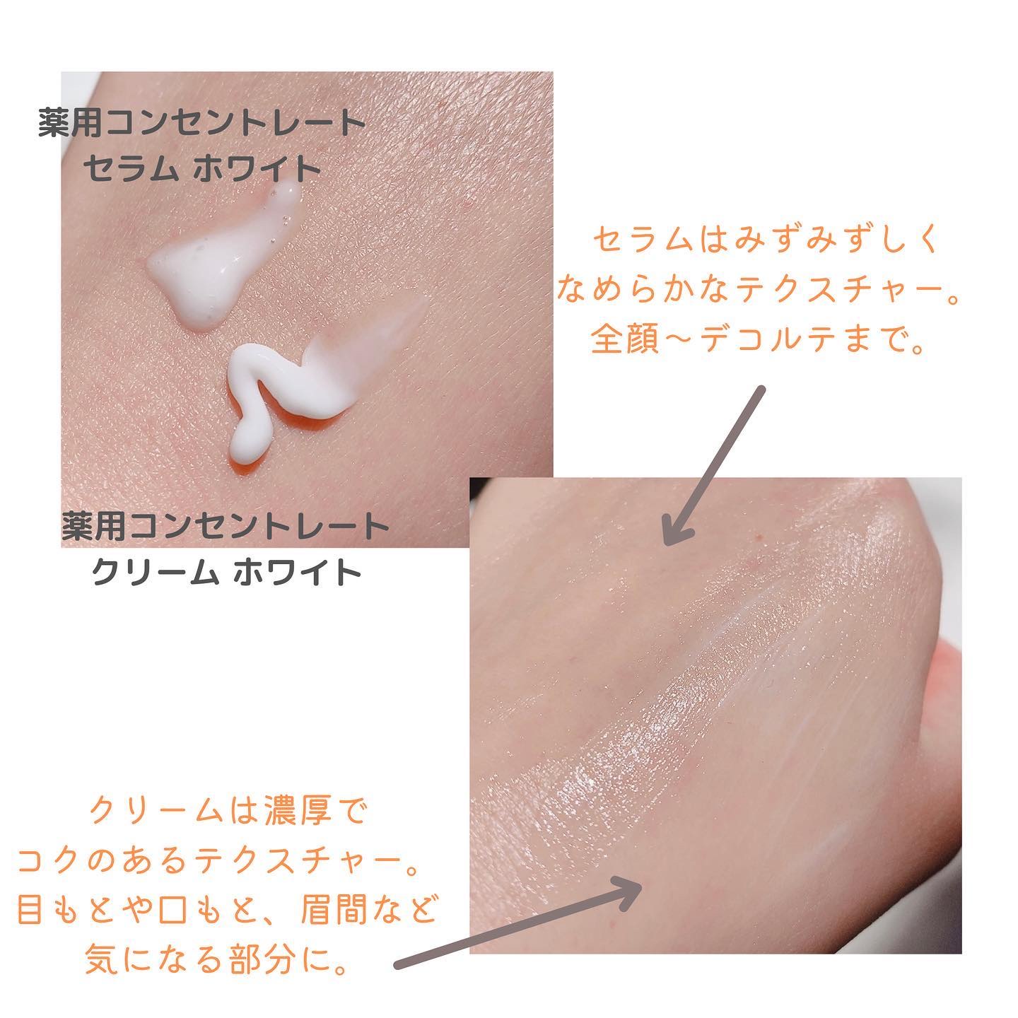 薬用コンセントレートクリーム　ホワイト/サナ　リンクルターン/フェイスクリームを使ったクチコミ（3枚目）