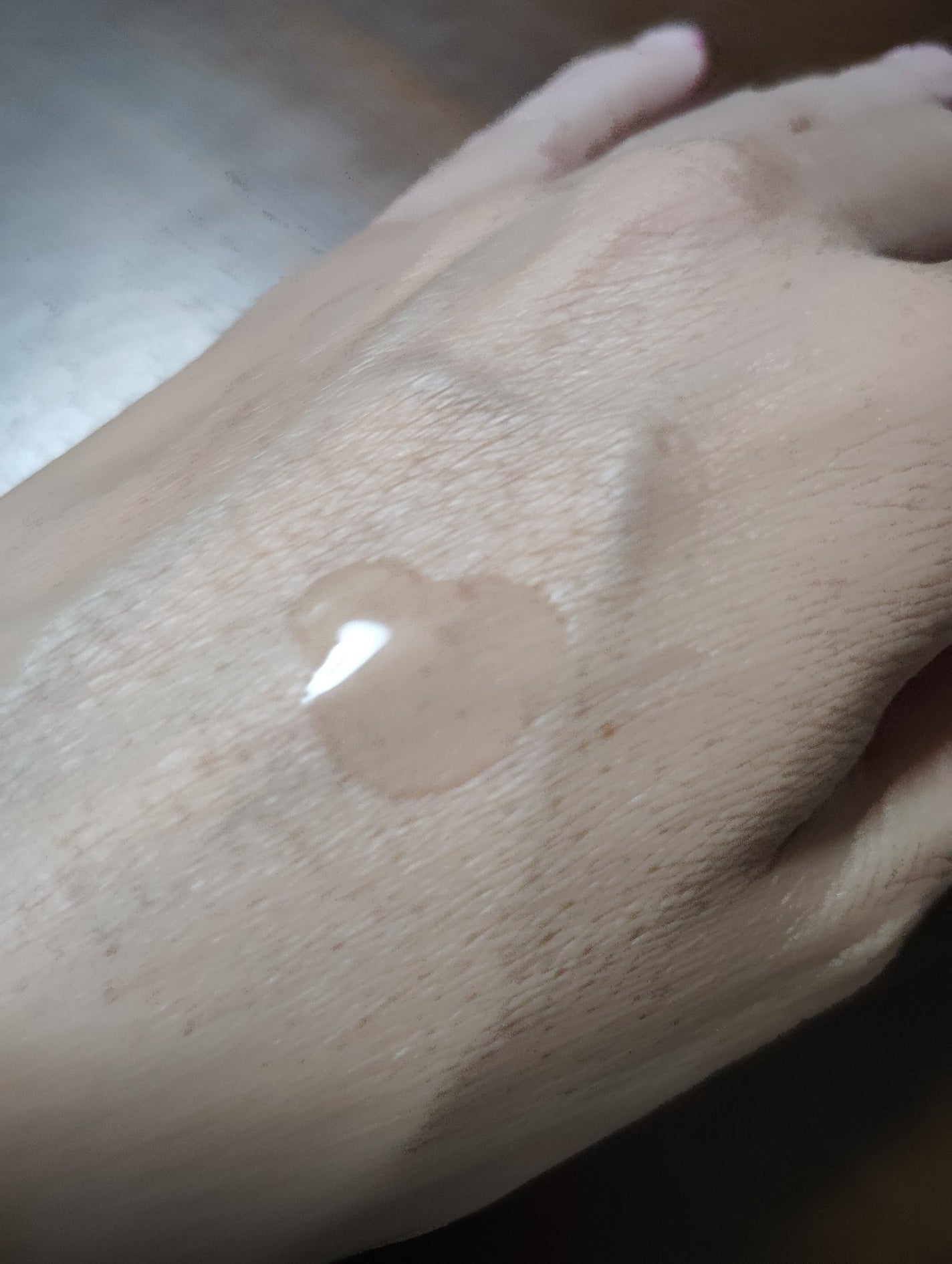 AZアゼライン酸15セラム/コスデバハ/美容液を使ったクチコミ(2枚目)