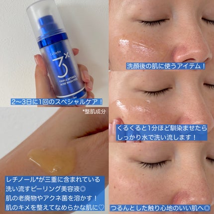 トリプル レチノール ウォッシュピール/Celladix/ピーリングを使ったクチコミ(2枚目)