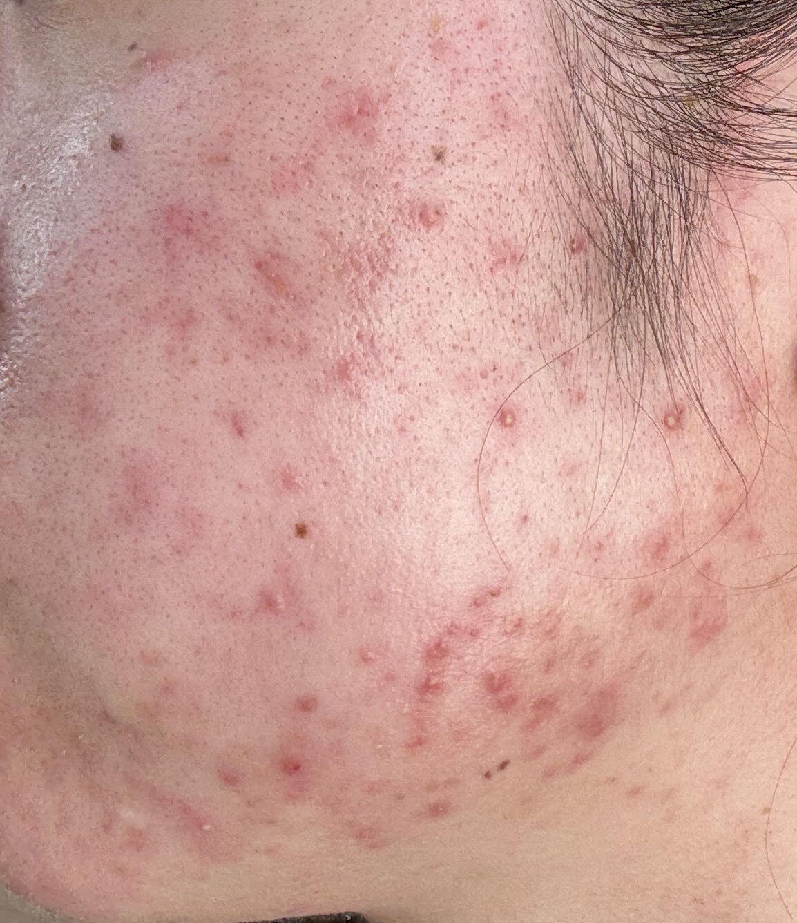 薬用泡洗顔/なめらか本舗/泡洗顔を使ったクチコミ（3枚目）