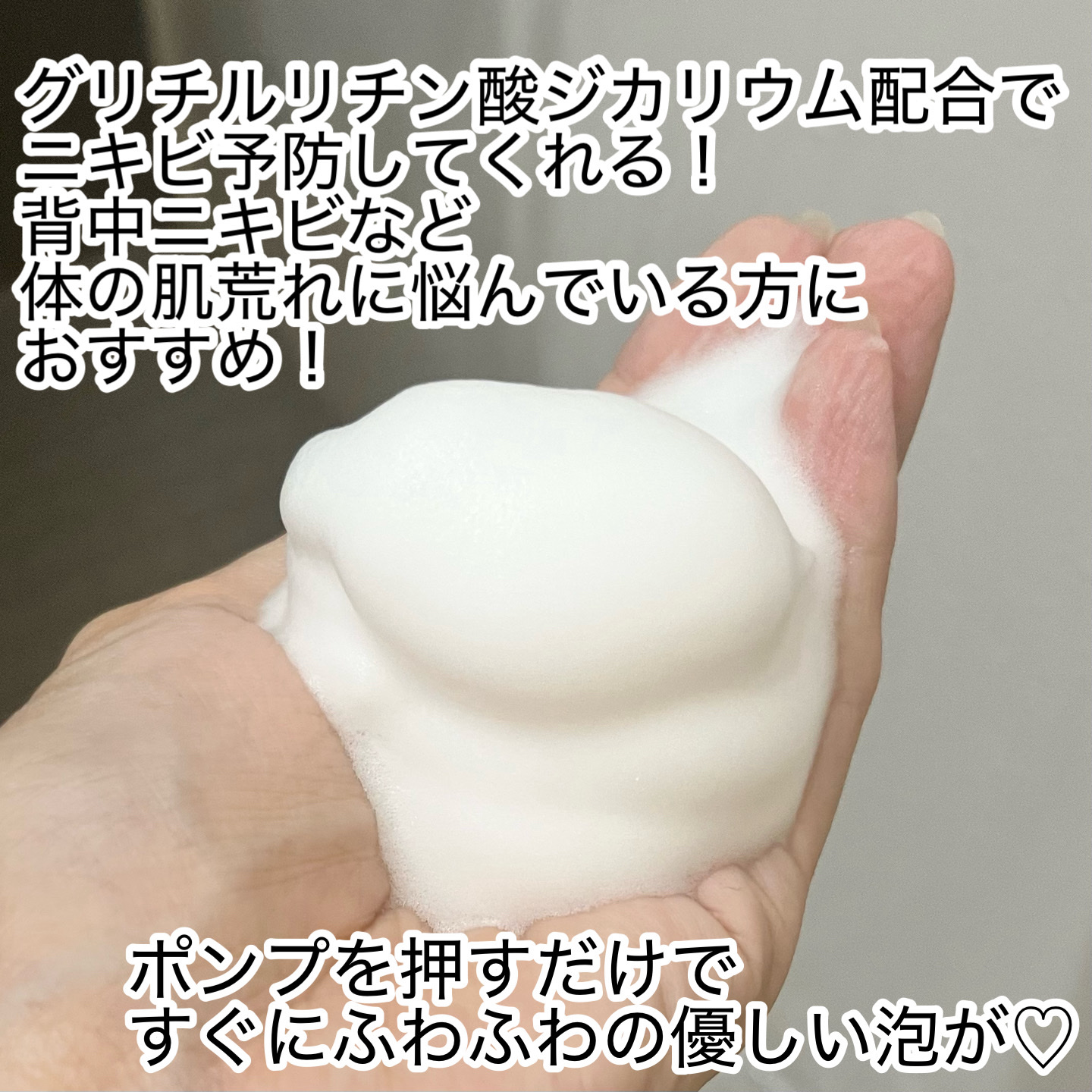 薬用　ダヴ　ニキビケア泡ボディウォッシュ　なめらか素肌/ダヴ/ボディソープを使ったクチコミ（2枚目）