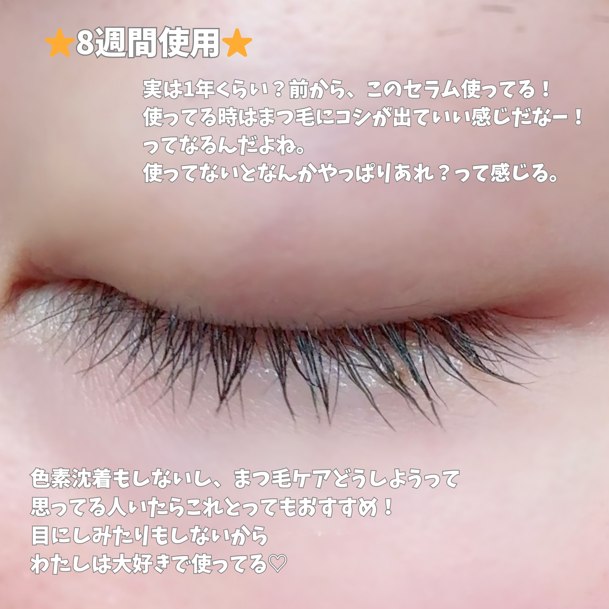 アイラッシュセラム100EX/COSNORI/まつげ美容液を使ったクチコミ（2枚目）
