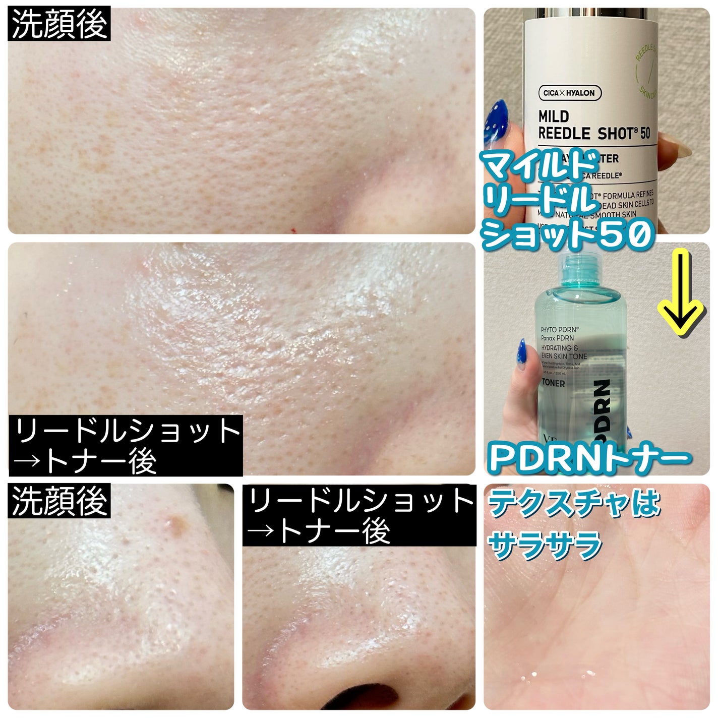 リードルショットシナジースパークリングトナー/VT/化粧水を使ったクチコミ(4枚目)