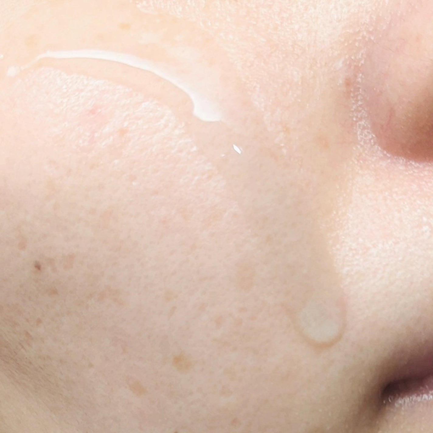 SOOTHE FORTE SERUM/essenciel/ブースター・導入液を使ったクチコミ(4枚目)