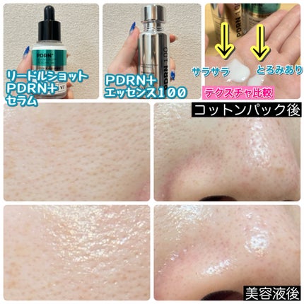 リードルショットシナジースパークリングトナー/VT/化粧水を使ったクチコミ(8枚目)