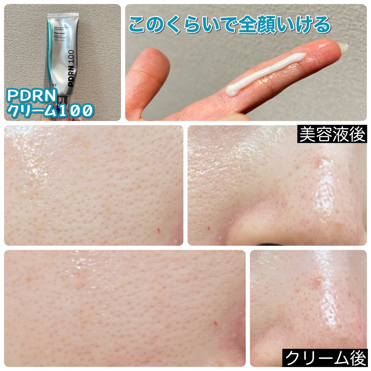 リードルショットシナジースパークリングトナー/VT/化粧水を使ったクチコミ(9枚目)