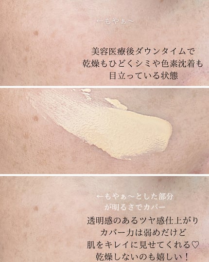 イーブン ベター メイクアップ V ファンデーション 50/CLINIQUE/リキッドファンデーションを使ったクチコミ(4枚目)