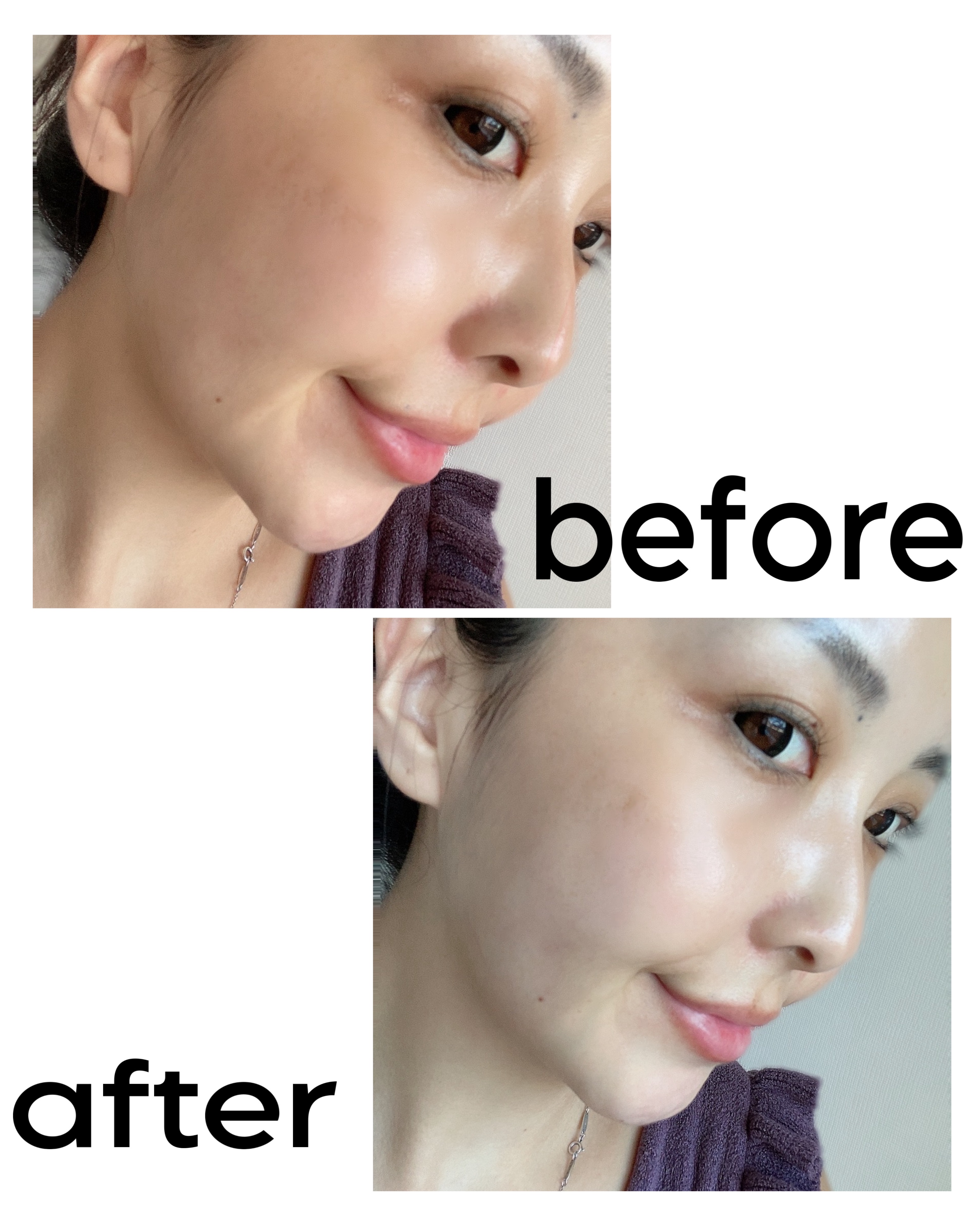 ヒアルキューブ フラッディングセラム/DPPR/美容液を使ったクチコミ（2枚目）