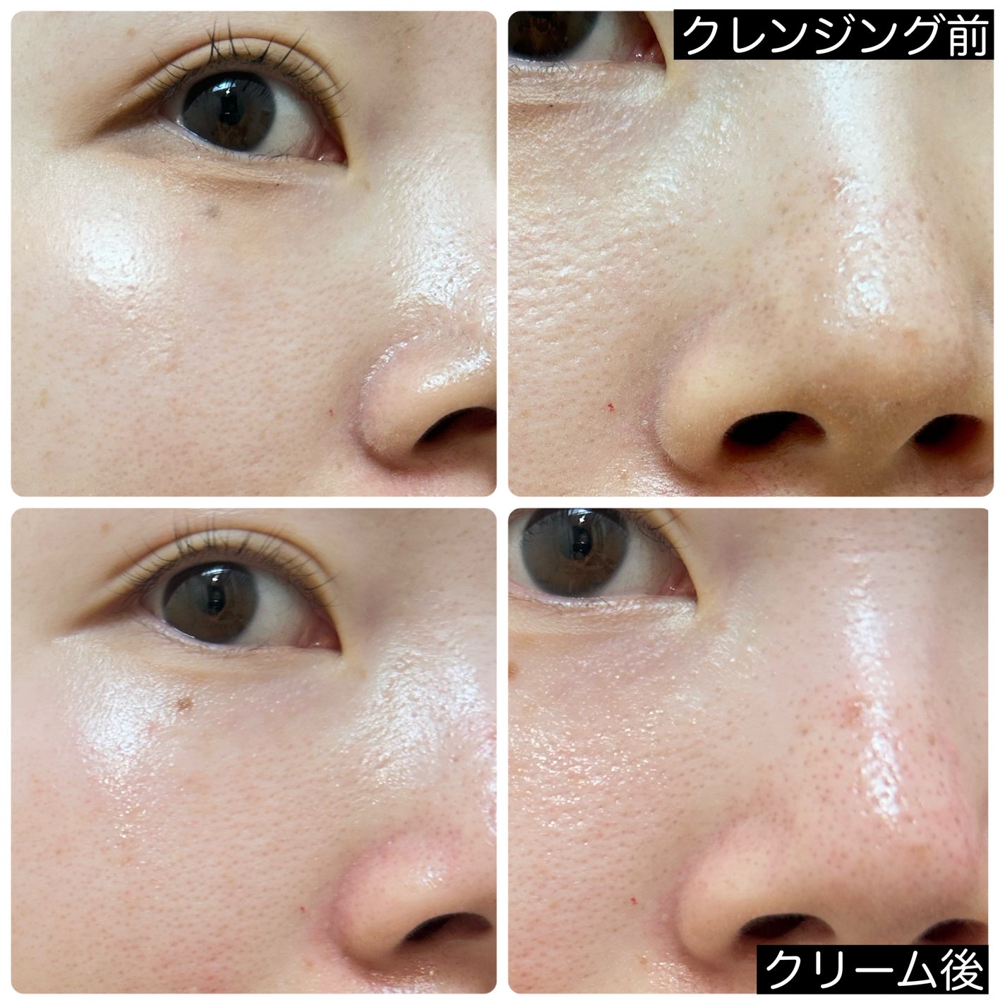 リードルショットシナジースパークリングトナー/VT/化粧水を使ったクチコミ(10枚目)