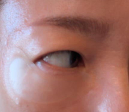 アイバックリフト1100シャットリードルパッチ/CHARDE/シートマスク・パックを使ったクチコミ(5枚目)