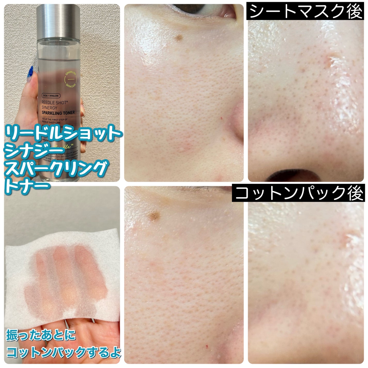 リードルショットシナジースパークリングトナー/VT/化粧水を使ったクチコミ(6枚目)