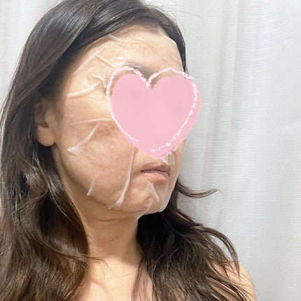 マデカッソシド ブレミッシュマスク/MEDIHEAL/シートマスク・パックを使ったクチコミ(5枚目)