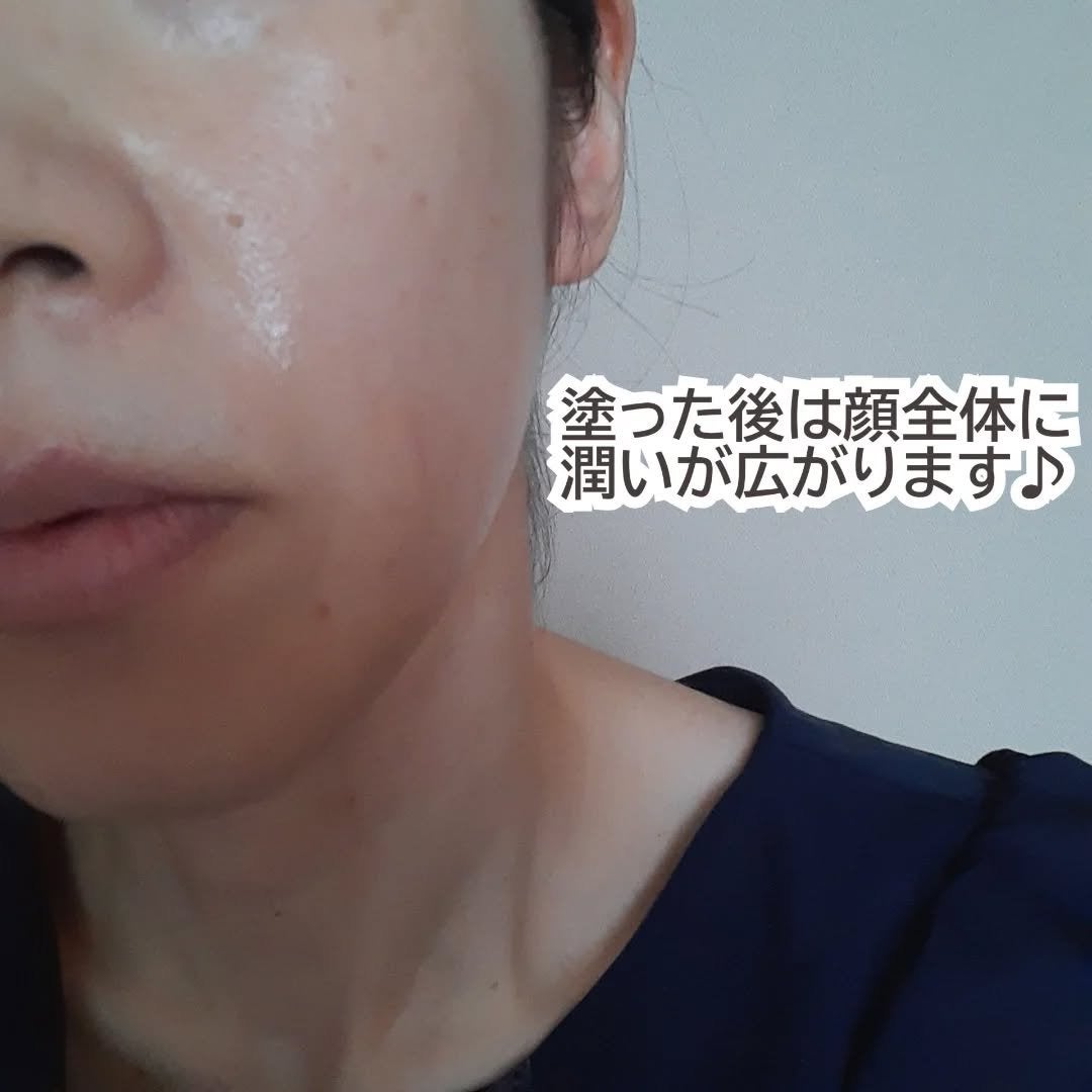 デュアル エフェクト アンプル/REJURAN COSMETICS/美容液を使ったクチコミ(5枚目)
